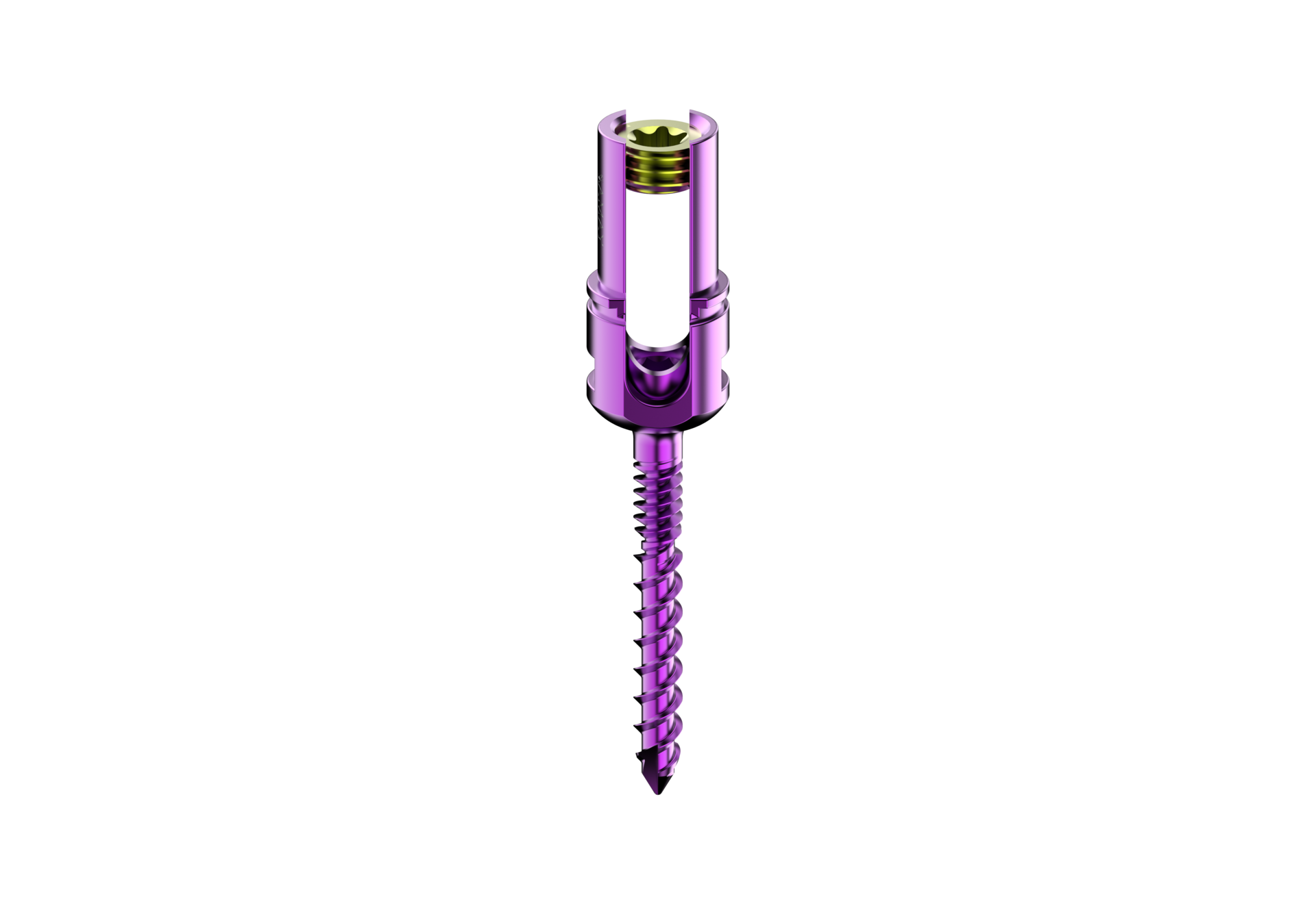 Polyaxial Reduction Dual Thread Screw Spine Screw